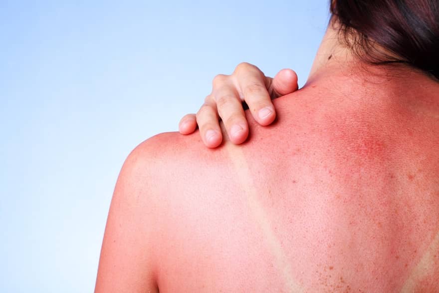 causes of skin cancer