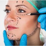 Plastic Surgeons