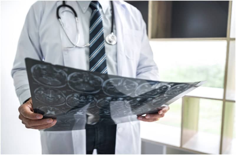 How to Choose a Neurosurgeon